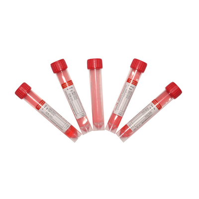 ISO 13485와 코 견본 PCR 탐지 바이러스의 RNA 작은 키트