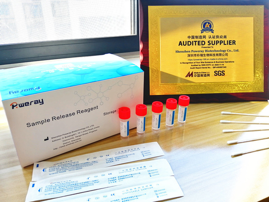 ISO 13485와 코 견본 PCR 탐지 바이러스의 RNA 작은 키트