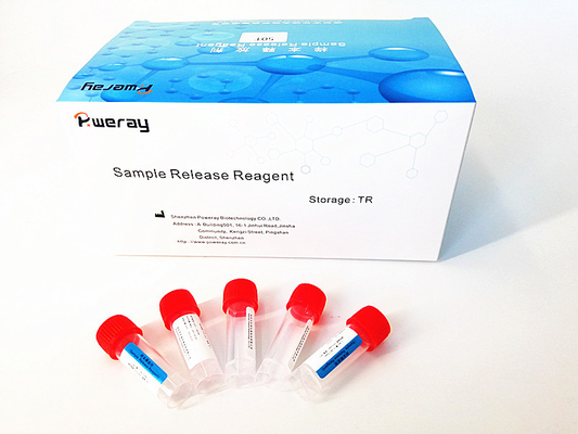 ISO 13485와 코 견본 PCR 탐지 바이러스의 RNA 작은 키트